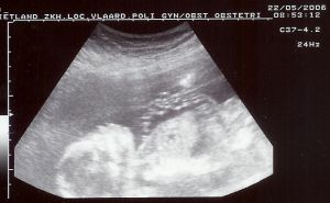 check out the cord!