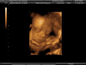 Baby duwt zich af tegen de baarmoederwand voor goeie foto.